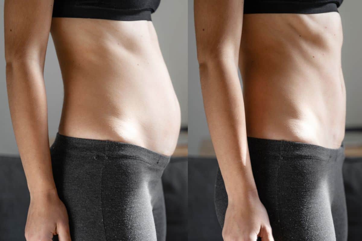 Post-Pregnancy: What Happens to Your Abdominal Muscles After Birth Ilford