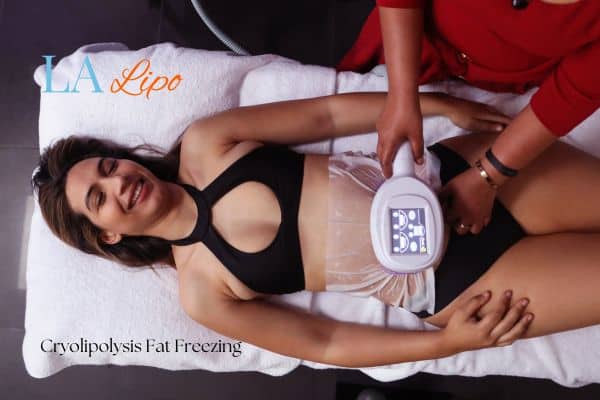 woman getting cryolipolysis Ilford