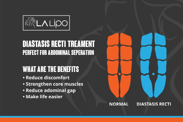 When to Be Concerned About Abdominal Muscle Changes Ilford