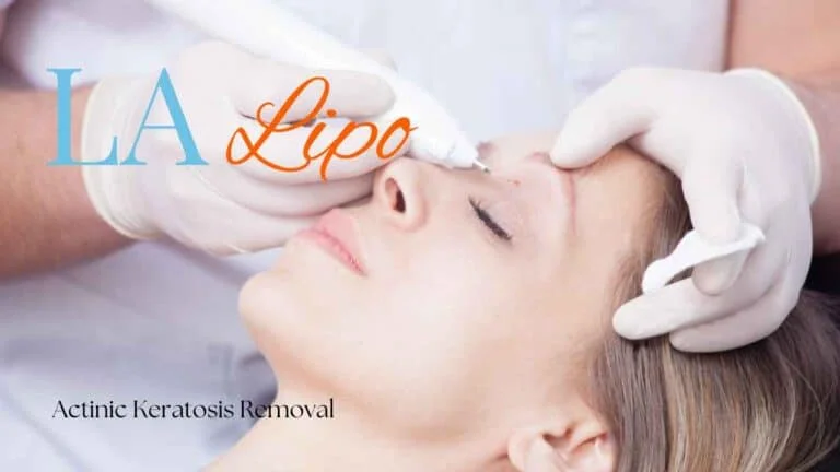 Woman receiving Actinic Keratosis Removal Treatment Ilford