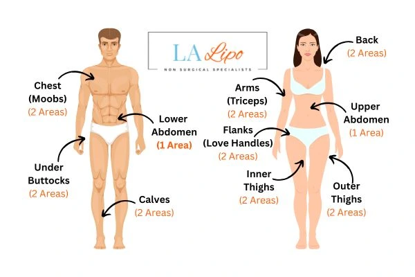 LA LIPO Cryolipolysis Areas Ilford