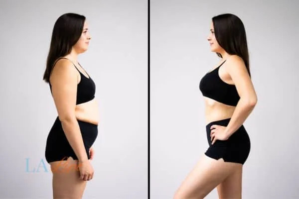 link between body image and mental health Ilford