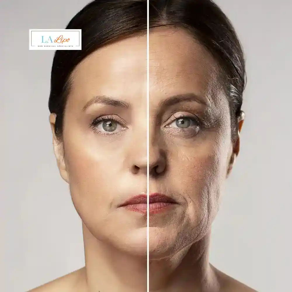 How Can You Tell If Non-Surgical Skin Tightening Is Right for You Ilford?