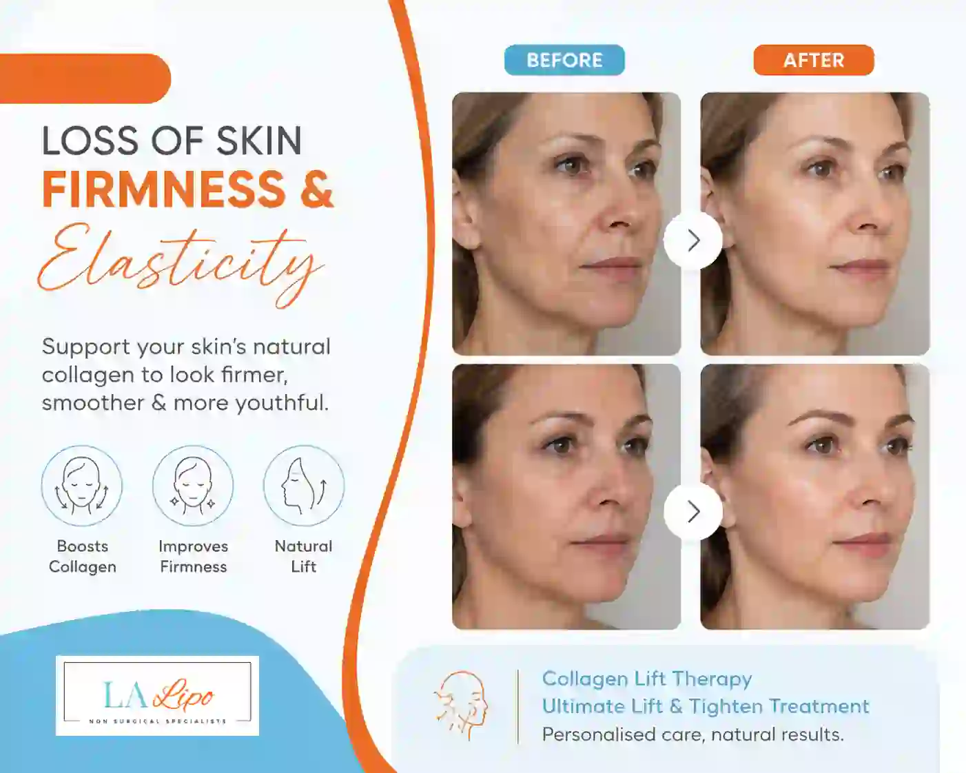 Sign #7: Loss of Skin Firmness and Elasticity Ilford