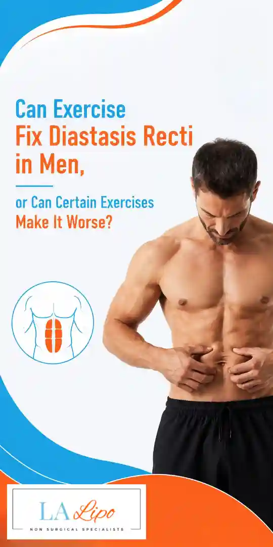 Can Exercise Fix Diastasis Recti in Men, or Can Certain Exercises Make It Worse Ilford?