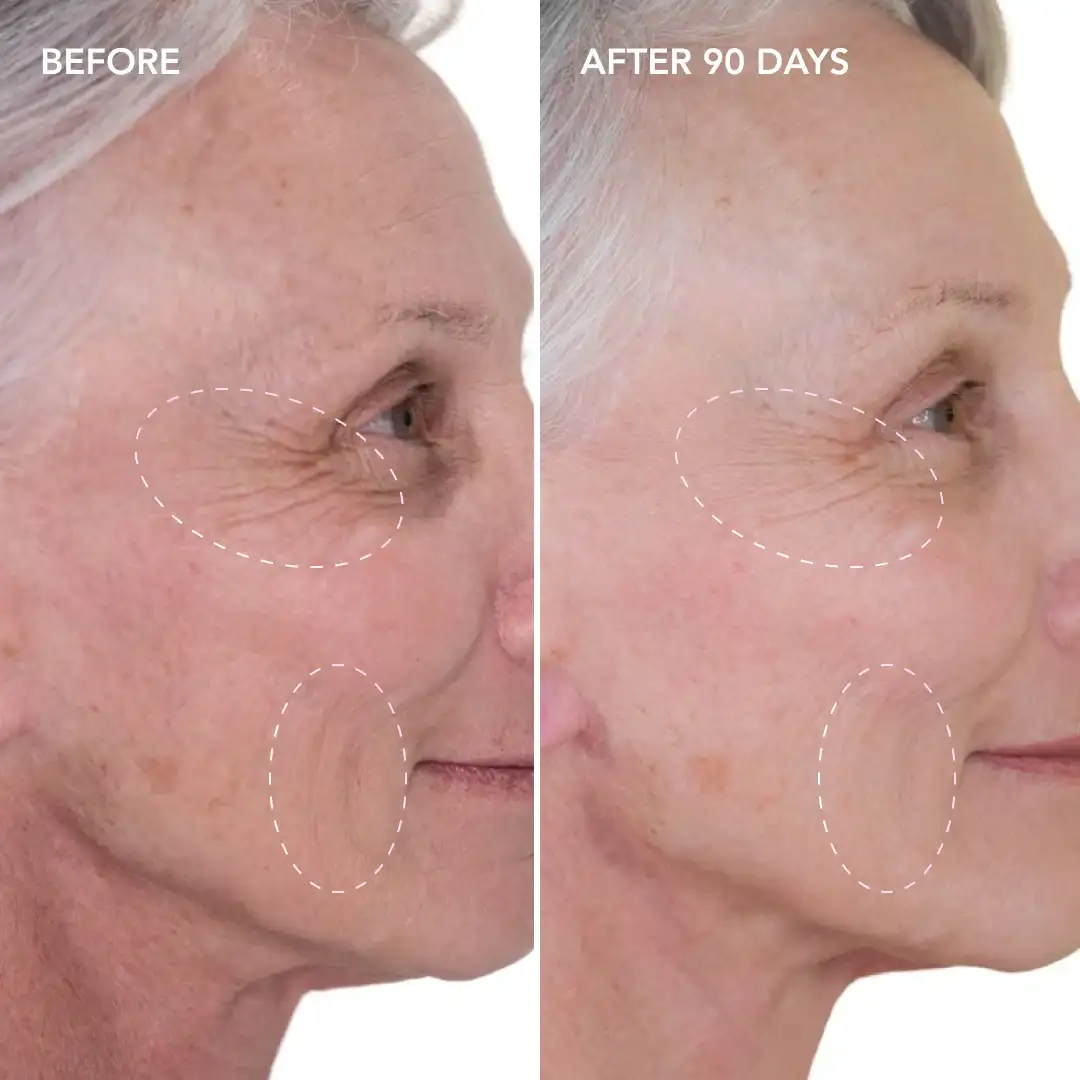 When will you see results Ilford